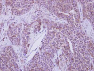 Immunohistochemistry-Paraffin: MSY2 Antibody [NBP2-19422]
