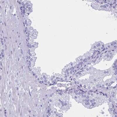 Immunohistochemistry-Paraffin: MSY2 Antibody [NBP2-33698]