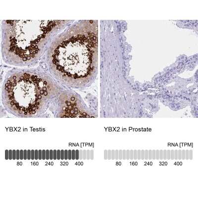 Immunohistochemistry-Paraffin: MSY2 Antibody [NBP2-33698]