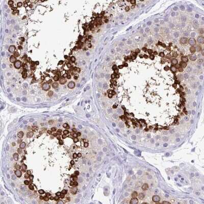 Immunohistochemistry-Paraffin: MSY2 Antibody [NBP2-33798]