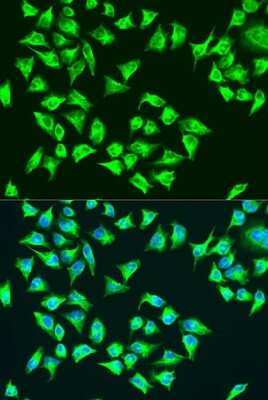 Immunocytochemistry/ Immunofluorescence: MT-ATP6 Antibody - Azide and BSA Free [NBP3-05578]