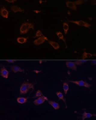 Immunocytochemistry/ Immunofluorescence: MT-ATP6 Antibody - Azide and BSA Free [NBP3-05579]