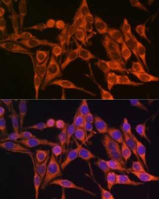 Immunocytochemistry/ Immunofluorescence: MT-ATP8 Antibody - Azide and BSA Free [NBP3-05560]