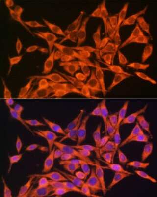 Immunocytochemistry/ Immunofluorescence: MT-ATP8 Antibody - Azide and BSA Free [NBP3-05560]