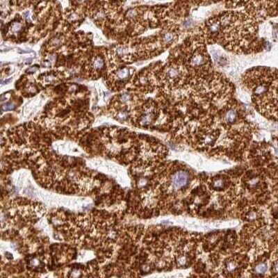 Immunohistochemistry-Paraffin: MT-CO2 Antibody [NBP2-37930]