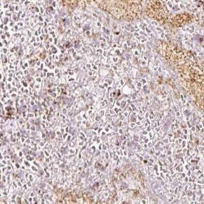 Immunohistochemistry-Paraffin: MT-CO2 Antibody [NBP2-37930]