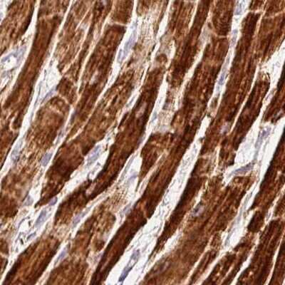 Immunohistochemistry-Paraffin: MT-CO2 Antibody [NBP2-37930]