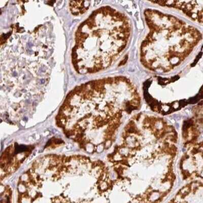 Immunohistochemistry-Paraffin: MT-CO2 Antibody [NBP2-37930]