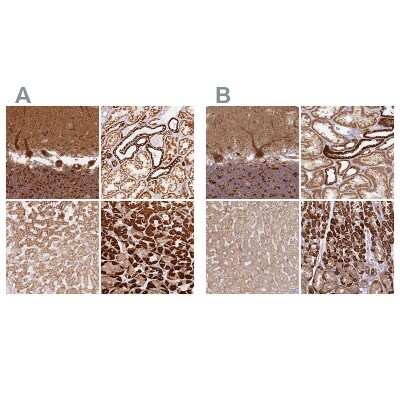 Immunohistochemistry-Paraffin: MT-CO2 Antibody [NBP2-37930]