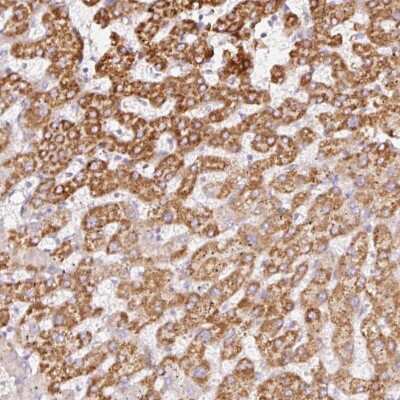 Immunohistochemistry-Paraffin: MT-CO2 Antibody [NBP2-37930]