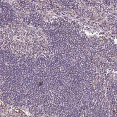 Immunohistochemistry-Paraffin: MT-CO2 Antibody [NBP2-37945]