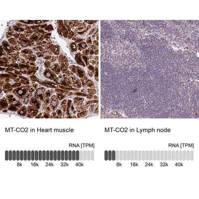 Immunohistochemistry-Paraffin: MT-CO2 Antibody [NBP2-37945]