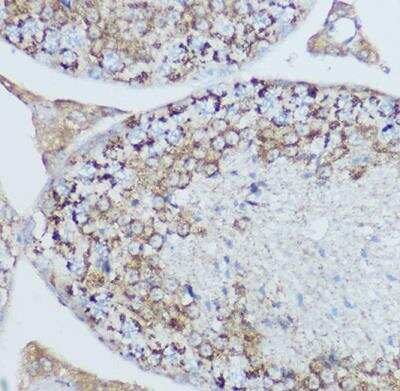 Immunohistochemistry-Paraffin: MT-CO2 Antibody - BSA Free [NBP2-94364]