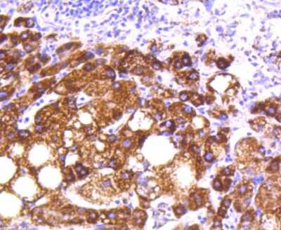 Immunohistochemistry-Paraffin: MT-CO2 Antibody (SC06-88) [NBP2-67617]