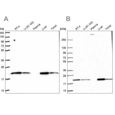 Western Blot: MT-CO2 Antibody [NBP2-37930]