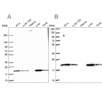 Western Blot: MT-CO2 Antibody [NBP2-37945]