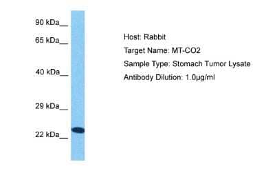 Western Blot: MT-CO2 Antibody [NBP2-87854]