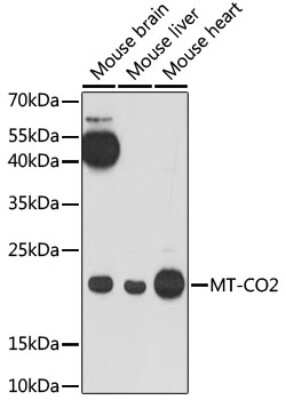 Western Blot: MT-CO2 AntibodyAzide and BSA Free [NBP2-93084]