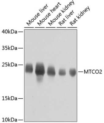 Western Blot: MT-CO2 AntibodyBSA Free [NBP2-94364]