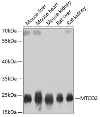 Western Blot: MT-CO2 AntibodyBSA Free [NBP2-94441]