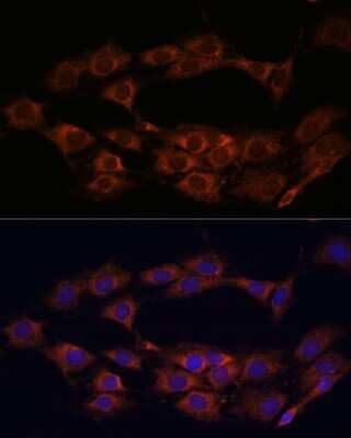 Immunocytochemistry/ Immunofluorescence: MT-ND1 Antibody - Azide and BSA Free [NBP2-94462]