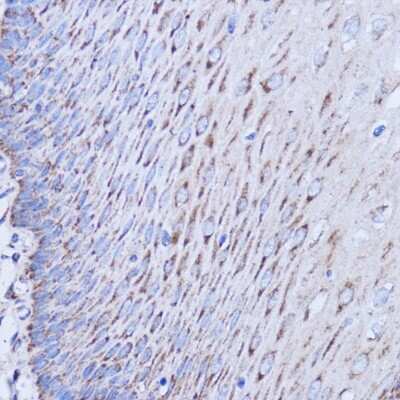 Immunohistochemistry-Paraffin: MT-ND1 Antibody - Azide and BSA Free [NBP2-94462]