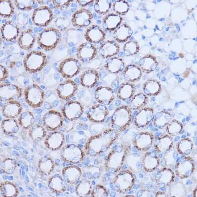 Immunohistochemistry-Paraffin: MT-ND1 Antibody - Azide and BSA Free [NBP2-94462]