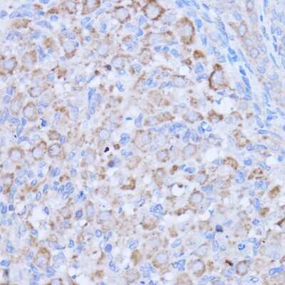Immunohistochemistry-Paraffin: MT-ND1 Antibody - Azide and BSA Free [NBP2-94462]