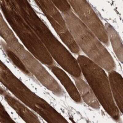 Immunohistochemistry-Paraffin: MT-ND1 Antibody [NBP3-17519]