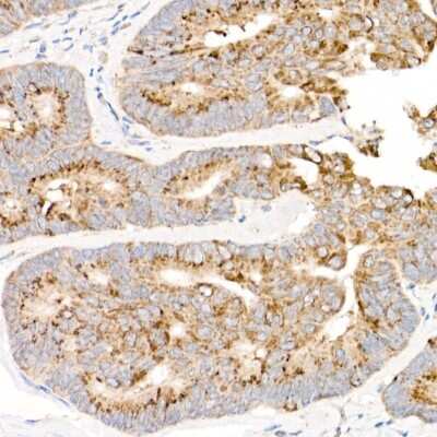 Immunohistochemistry-Paraffin: MT-ND2 Antibody - Azide and BSA Free [NBP3-05589]
