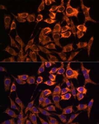 Immunocytochemistry/ Immunofluorescence: MT-ND3 Antibody - Azide and BSA Free [NBP2-93832]