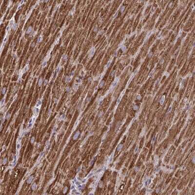 Immunohistochemistry-Paraffin: MT-ND3 Antibody [NBP2-38021]