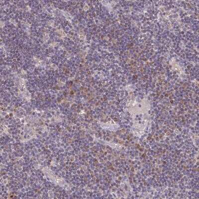 Immunohistochemistry-Paraffin: MT-ND3 Antibody [NBP2-38021]