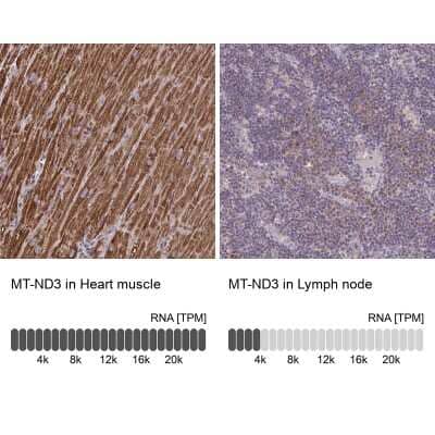 Immunohistochemistry-Paraffin: MT-ND3 Antibody [NBP2-38021]