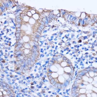 Immunohistochemistry-Paraffin: MT-ND3 Antibody - Azide and BSA Free [NBP2-93832]