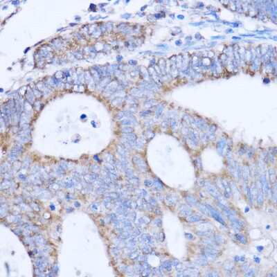 Immunohistochemistry-Paraffin: MT-ND3 Antibody - Azide and BSA Free [NBP2-93832]