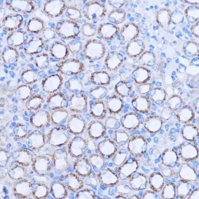 Immunohistochemistry-Paraffin: MT-ND3 Antibody - Azide and BSA Free [NBP2-93832]