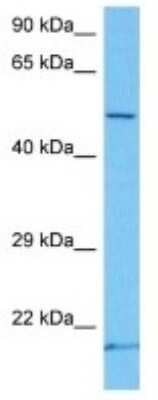 Western Blot: MT-ND4 Antibody [NBP3-10134]