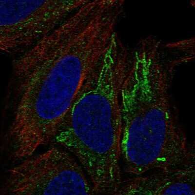 Immunocytochemistry/ Immunofluorescence: MT-ND4L Antibody [NBP2-58026]