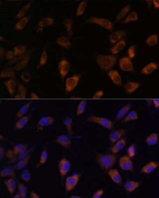 Immunocytochemistry/ Immunofluorescence: MT-ND4L Antibody - Azide and BSA Free [NBP3-05239]