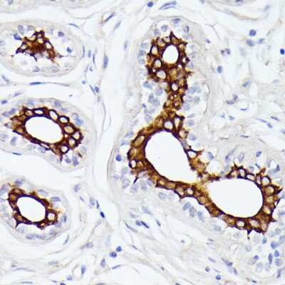 Immunohistochemistry-Paraffin: MT-ND5 Antibody - Azide and BSA Free [NBP3-05604]