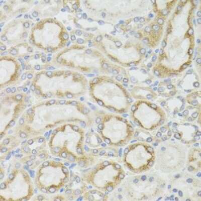 Immunohistochemistry-Paraffin: MT-ND5 Antibody - BSA Free [NBP3-05606]