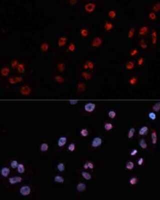 Immunocytochemistry/ Immunofluorescence: MT2A Antibody - Azide and BSA Free [NBP3-05238]