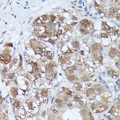 Immunohistochemistry-Paraffin: MT2A Antibody - Azide and BSA Free [NBP3-15974]