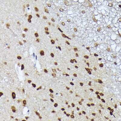 Immunohistochemistry-Paraffin: MT2A Antibody - Azide and BSA Free [NBP3-15974]