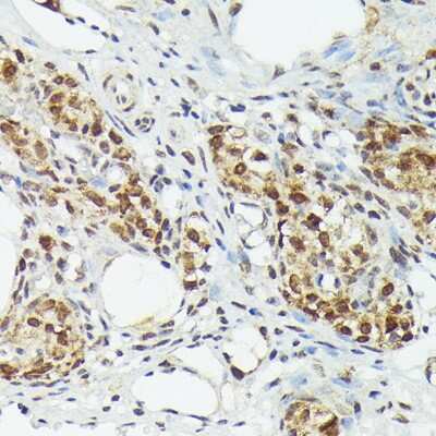 Immunohistochemistry-Paraffin: MT2A Antibody - Azide and BSA Free [NBP3-15974]