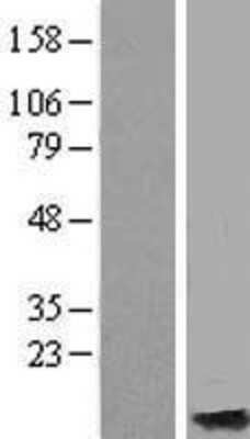 Western Blot: MT4 Overexpression Lysate [NBP2-05957]