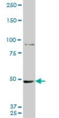 Western Blot: MTA1 Antibody (1C3) [H00009112-M10]