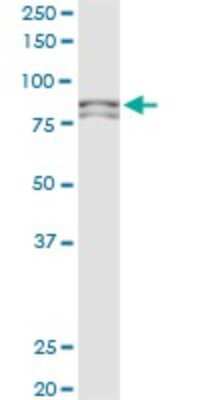 Western Blot: MTA1 Antibody (2D4) [H00009112-M03]