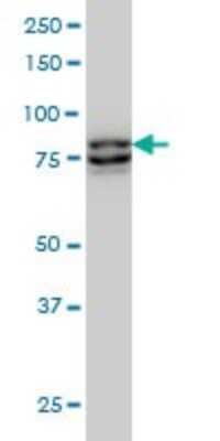 Western Blot: MTA1 Antibody (4D11) [H00009112-M02]